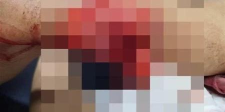 بسبب
      الخلاف
      على
      ثمن
      المشتريات..
      3
 ...
