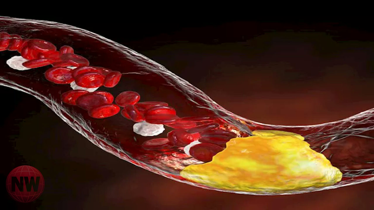 رمضان: كيف يؤثر الطعام على الكوليسترول وأعراضه ونصائح الوقاية