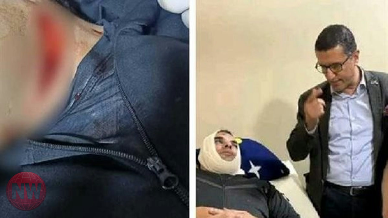 وزير الرياضة يتابع حالة مدير مركز شباب أبو حماد بعد اعتداء عنيف